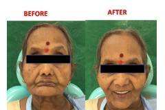 best-dental-care-in-mallapur-hyderabad