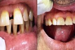 dental-clinics-near-ecil