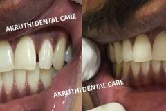 dentist-mallapur